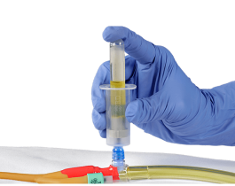 Amélioration des prélèvements d’échantillons urinaires grâce aux cathéters de Foley
