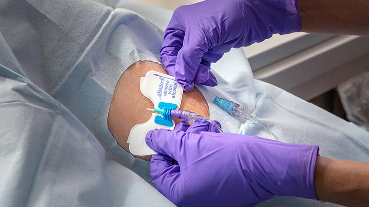 <h3>SECURE the catheter</h3>
<p>Stabilise and secure&nbsp;the catheter at the insertion site. Using adhesive-based engineered stabilisation devices&nbsp;(ESDs) may reduce the risk of complications, including infection and catheter dislodgement.<sup>2*</sup></p>
<ul>
<li>IV stabilisation devices</li>
</ul>
<p><sup>2*. Infusion Nurses Society. Infusion Therapy Standards of Practice. J Infus Nurs. 2021; 44(1S): S109.</sup></p>
<p><a href="#contactus" target="_blank" rel="noopener noreferrer">Let us help identify potential gaps to improve clinical practice in your facility &gt;&gt;</a></p>
<p>&nbsp;</p>
