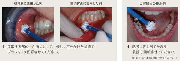 WH-Oral-cytology-sample-collection-method-1