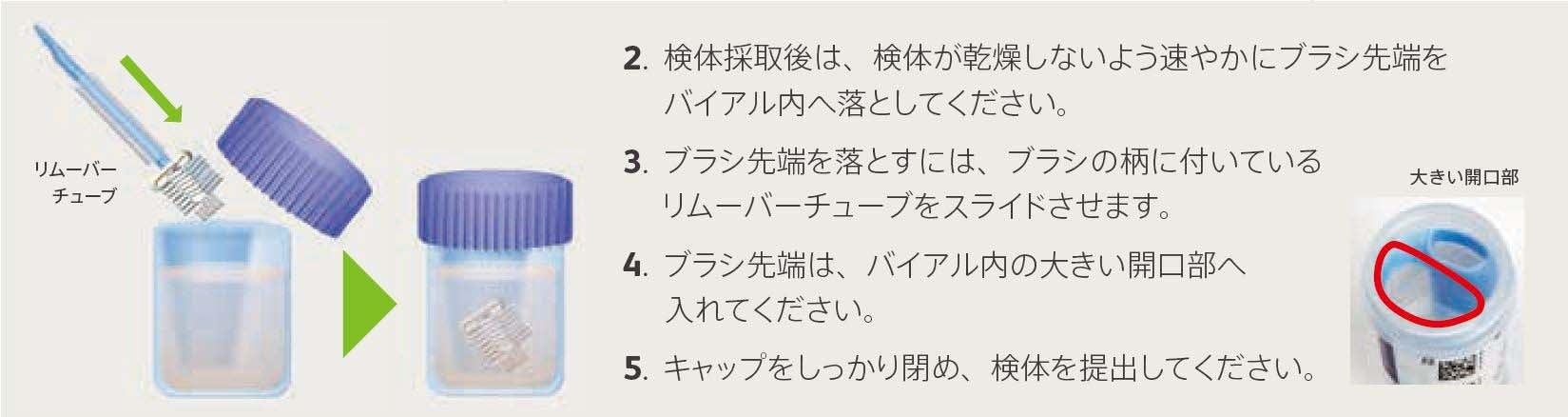 DS_cervical_cancer_koukuu_3