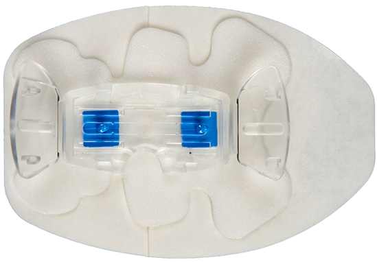 BD® StatLock™ PICC Plus Paediatric, Sliding Post, Foam - VPPPSPCE | BD