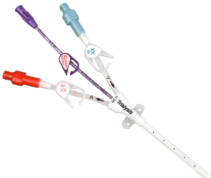 Tesio Hd Catheter Tesio Hd Catheter
