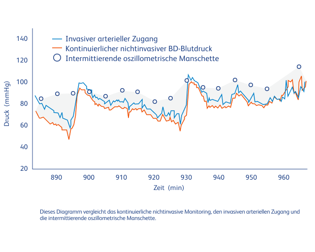 Verringerung der intraoperativen Hypotonie durch kontinuierliche Einblicke