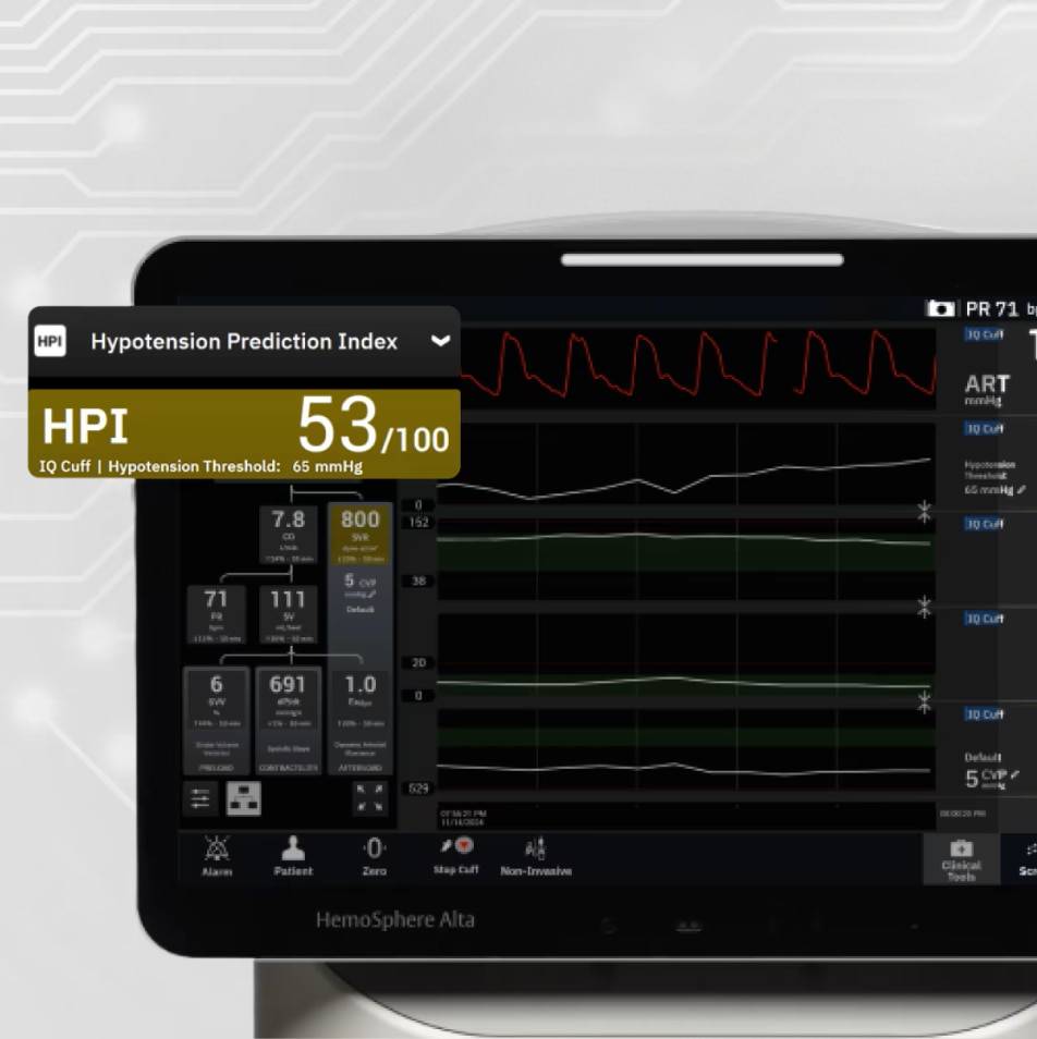 HPI Screen 
