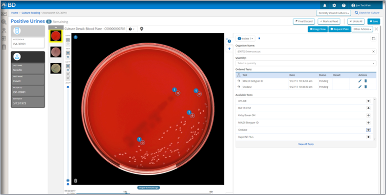 Image Reading with BD Synapsys