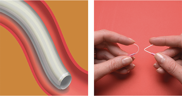 BD® Vialon™ catheter 