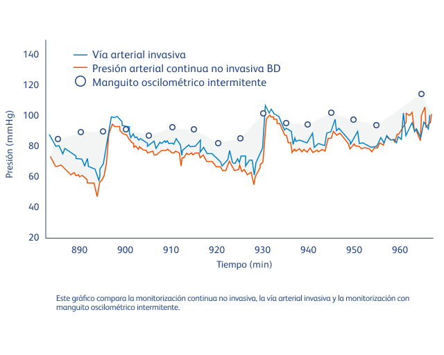 Reduzca la hipotensión intraoperatoria con información continua