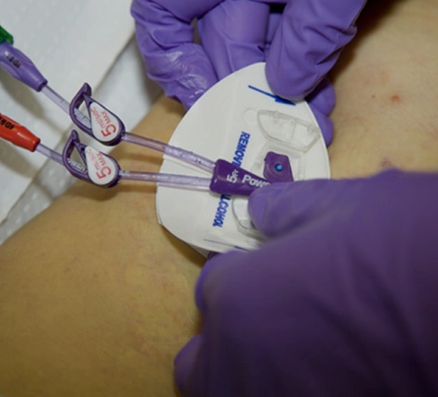 <p>4. Estabilizar</p>
