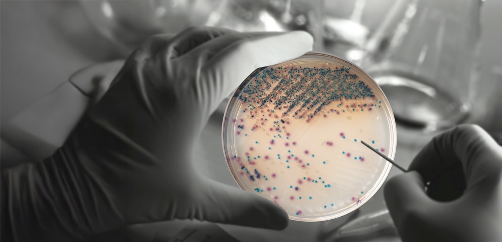 BD BBL CHROMagar Plated Media Hero Banner V5