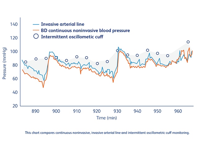 <p>Reduce intraoperative hypotension with continuous insights</p>
