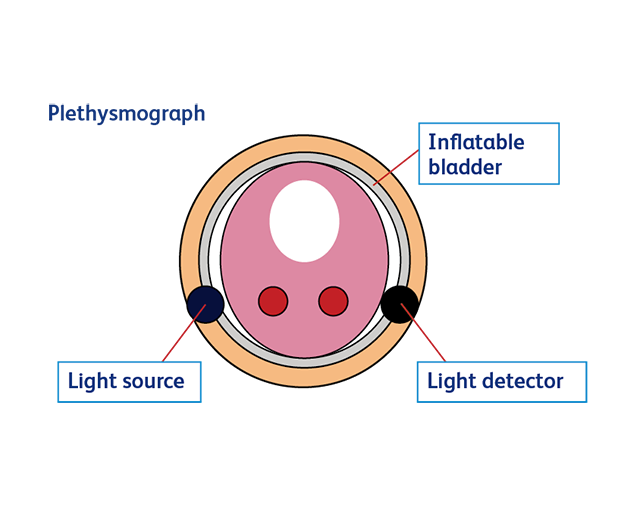 Plethysmograph illustration