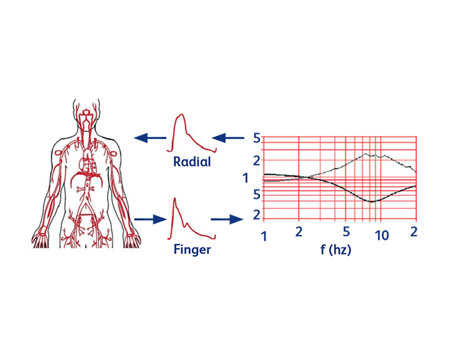 Brachial pressure reconstruction technical overview illustration