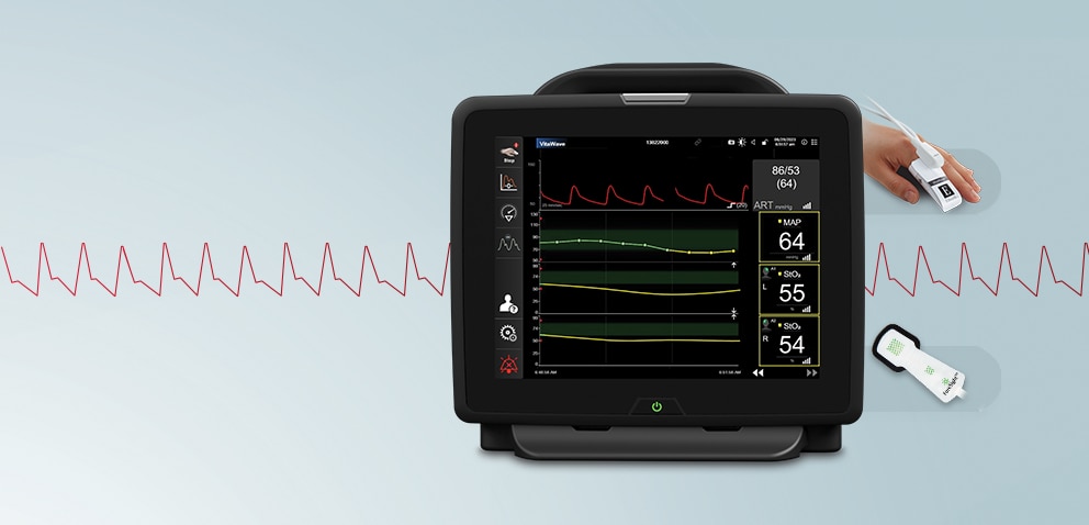 hemosphere-vita-monitor-spotlighthero