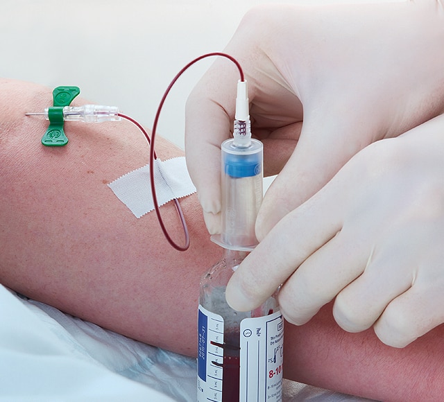 BD BACTEC™ Blood Collection Bottle