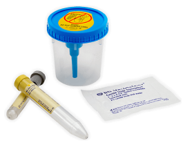 vacutainer-complete-urine-kit_C_PAS_UC_0616-0008