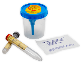 vacutainer-complete-urine-kit_RC_PAS_UC_0616-0007