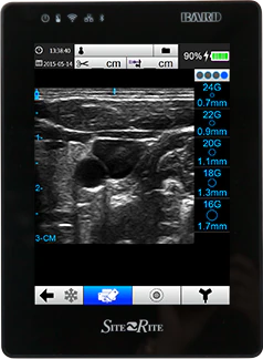 Traditional ultrasound imaging systems allow you to:
