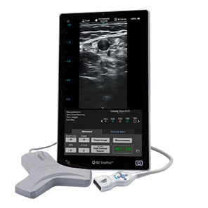 siterite 9 ultrasound system