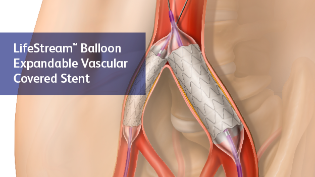 BD-70801 LSTRM_Images_For BD Product Wepage_624x35-1