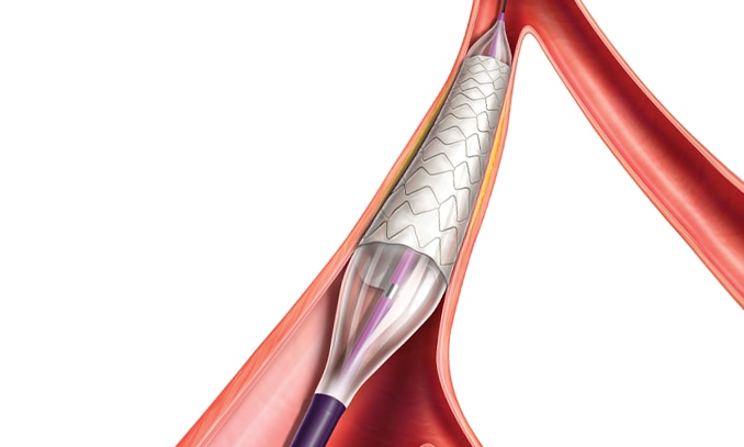 BD-70801 LSTRM_Images_For BD Product Wepage_907x478b