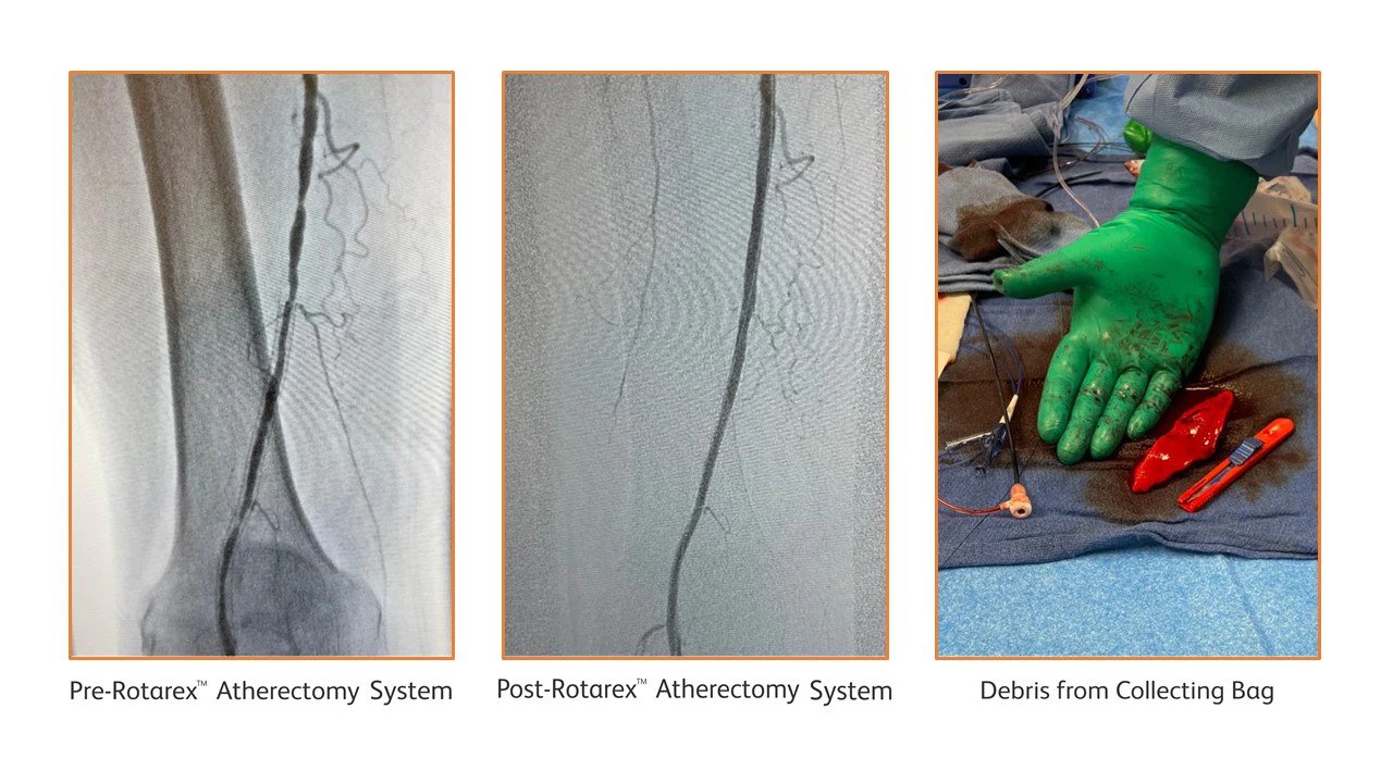 <h3>Dr. Aaron Frodsham, MD.&nbsp; Salt Lake City, UT, USA</h3>

