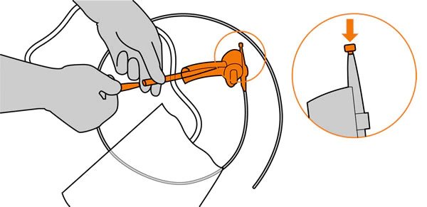 <h5>STEP FOUR:</h5>
<p>Remove catheter from packaging and connect collecting bag</p>
