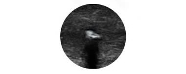 Polymer- und gelfrei