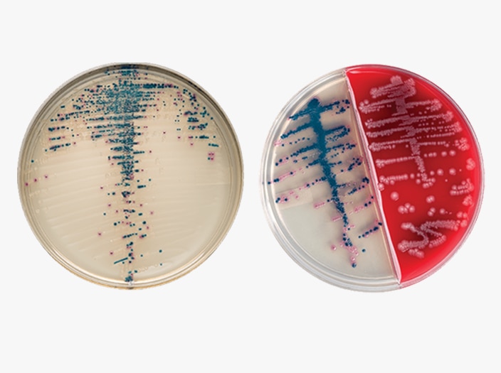 BD BBL CHROMagar prepared plated media Petri-style dishes