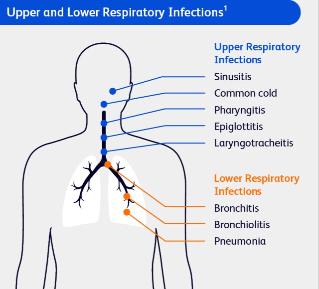 Diagram of Upper and Lower Respiratory Infections