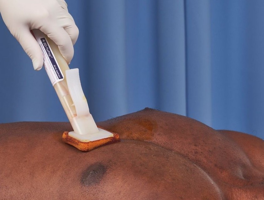 BD PurPrep Pateitn Preoperative Skin Preparation with Sterile Solution
