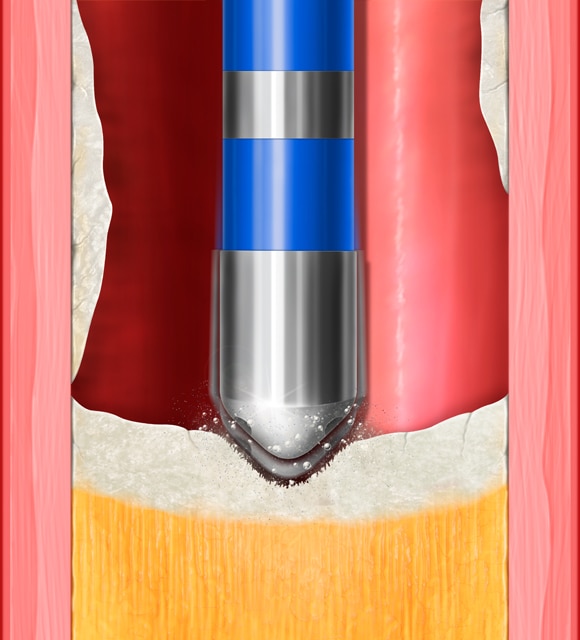 <p>機械的振動</p>
