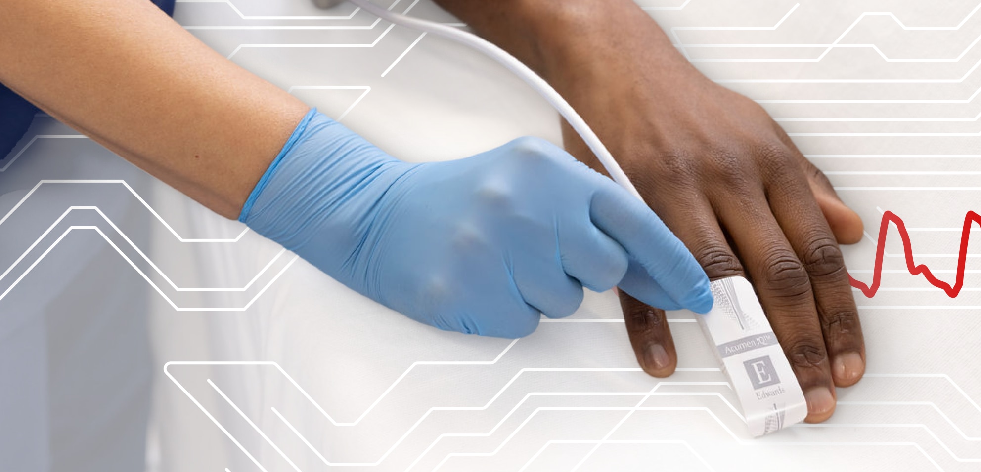 Acumen IQ Plus cuff header