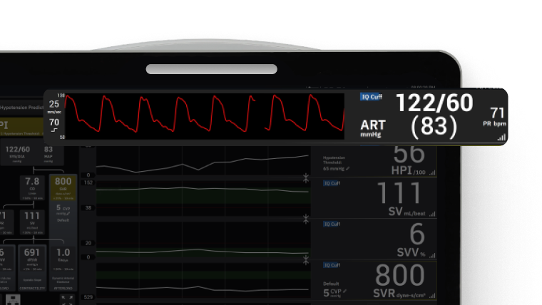 Acumen IQ™ Cuff setup guide