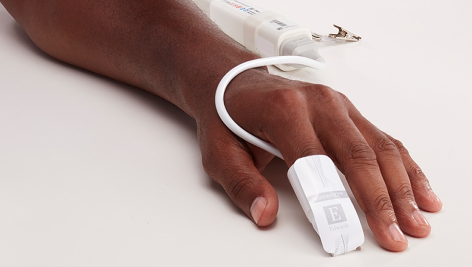 Acumen IQ™ Cuff setup guide