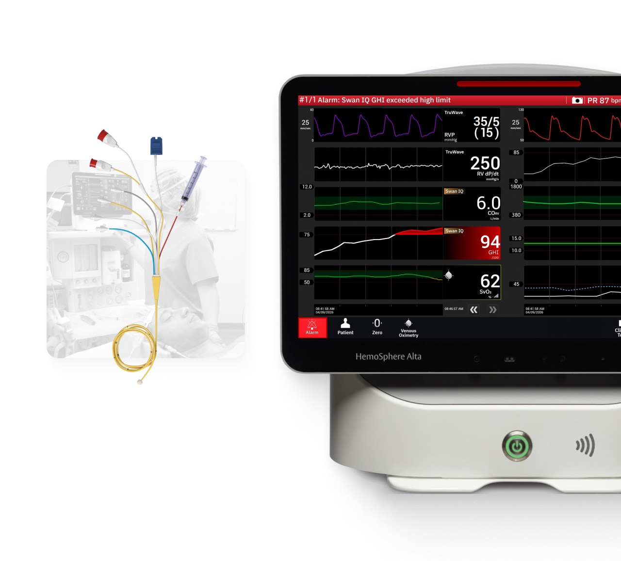 HS Alta 3 Multisensor 10 Trends 1 Build