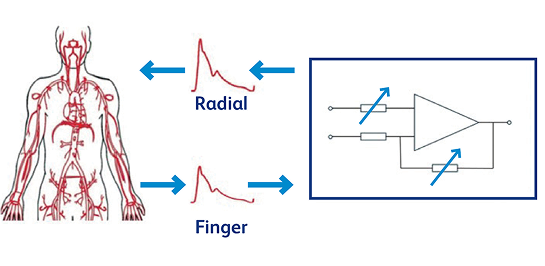 radial pressure graphic