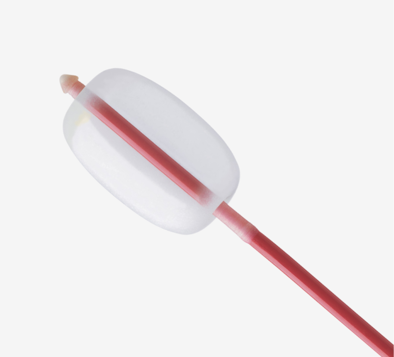 Fortis arterial embolectomy