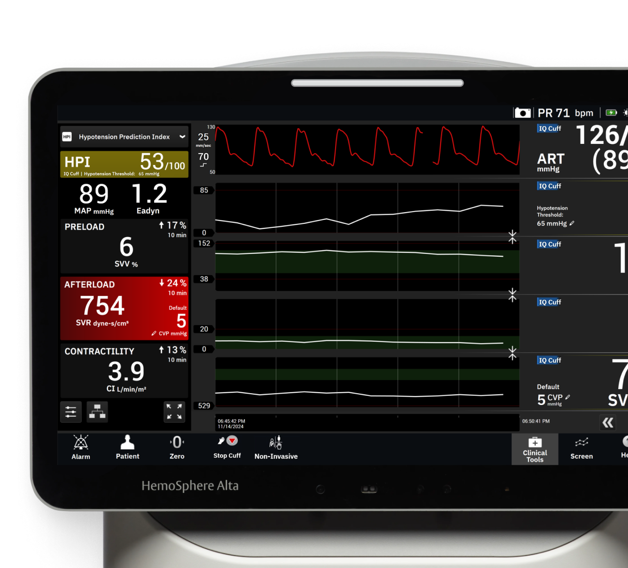 smart alerts - Alta monitor