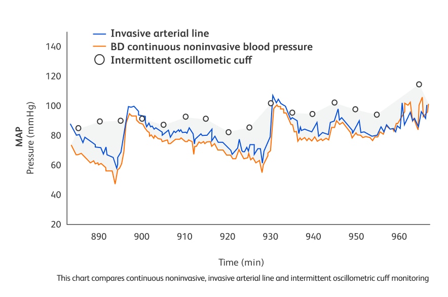 continuous vs intermittent BP