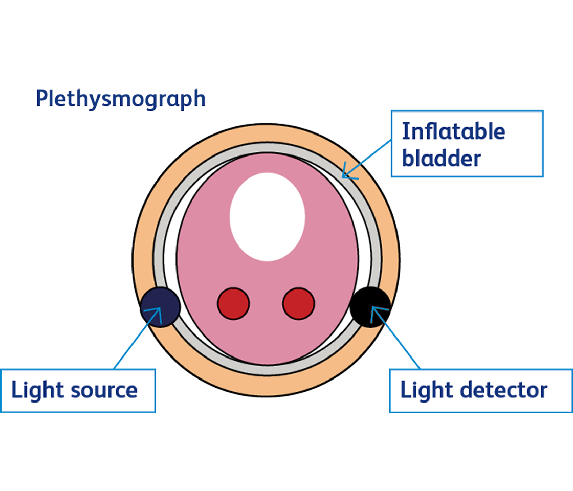 plethysmograph illustration