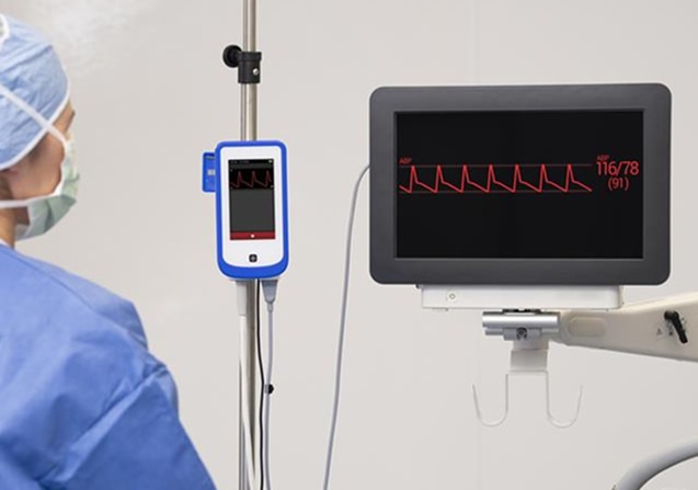 Stream monitor photo