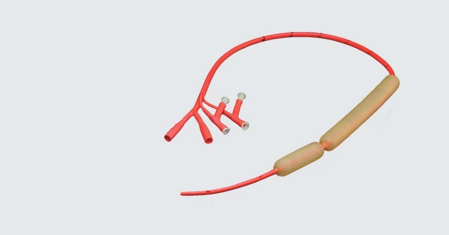 Esophageal Hero Image